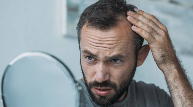 What is the best suitable age to get a hair transplant?