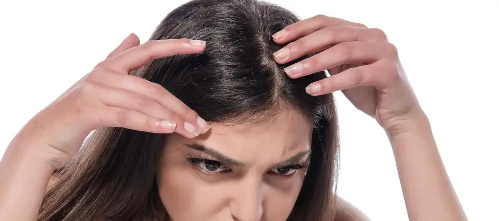 A person showing her scalp Problems with both hand.