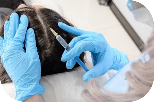 A close-up view of a scalp treatment where hands in blue gloves are administering an injection into the scalp