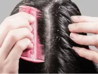 A person using a pink comb to part and style dark, shiny hair. The hair in the image appears to have dandruff and scalp problems.