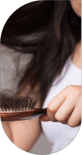A women worried about her hair fall and showing here hair brush with tangled hair around it.